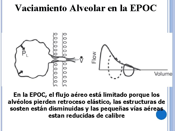Vaciamiento Alveolar en la EPOC En la EPOC, el flujo aéreo está limitado porque
