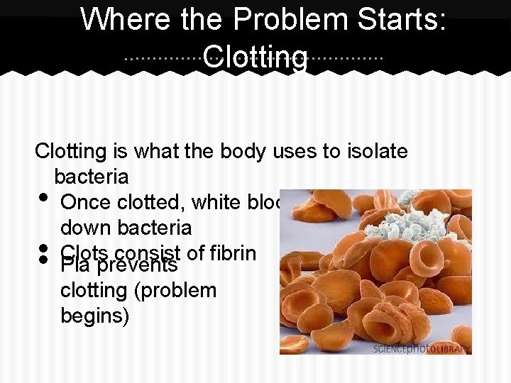 Where the Problem Starts: Clotting is what the body uses to isolate bacteria Once