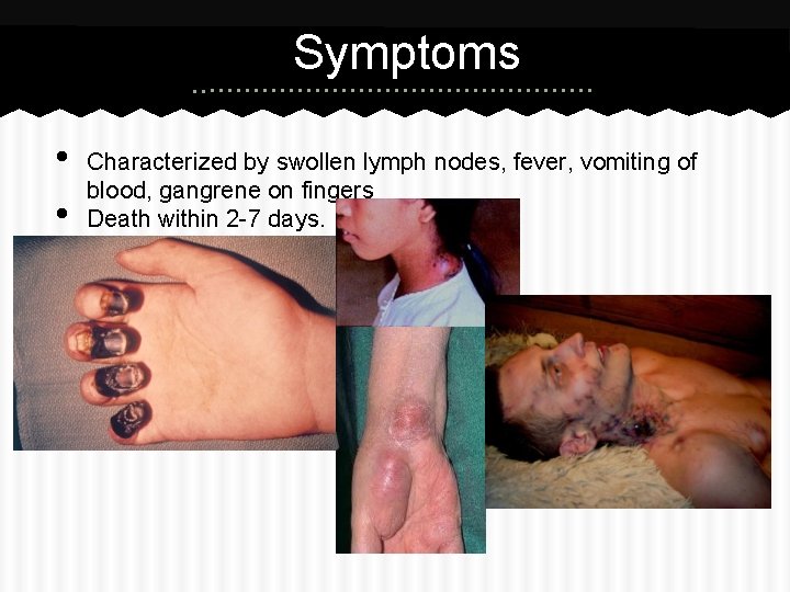 Symptoms • • Characterized by swollen lymph nodes, fever, vomiting of blood, gangrene on