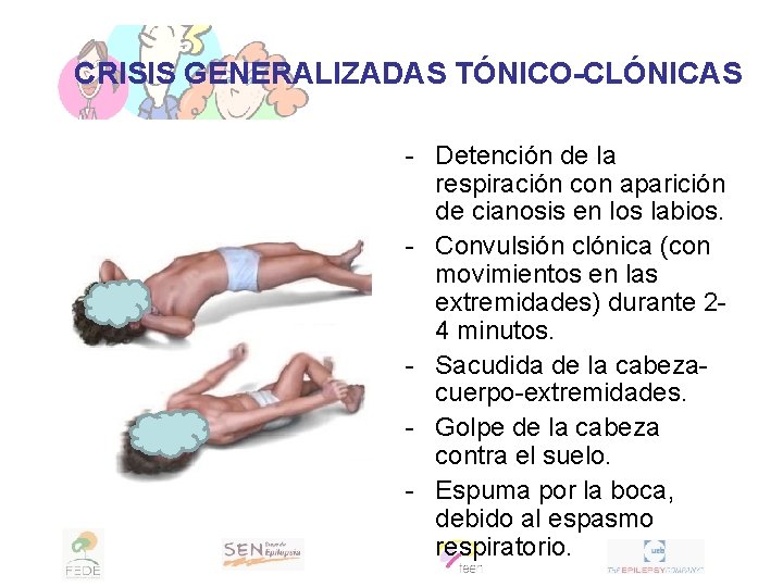 CRISIS GENERALIZADAS TÓNICO-CLÓNICAS - Detención de la respiración con aparición de cianosis en los