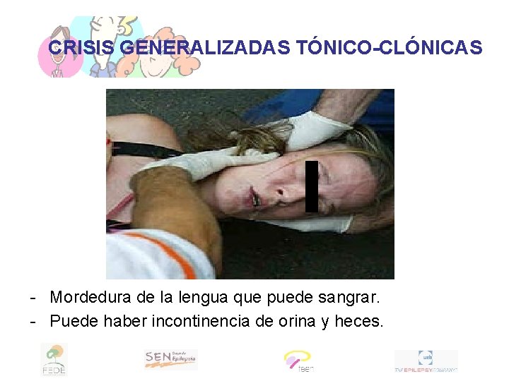 CRISIS GENERALIZADAS TÓNICO-CLÓNICAS - Mordedura de la lengua que puede sangrar. - Puede haber