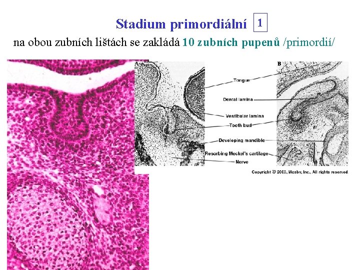 Stadium primordiální 1 na obou zubních lištách se zakládá 10 zubních pupenů /primordií/ 