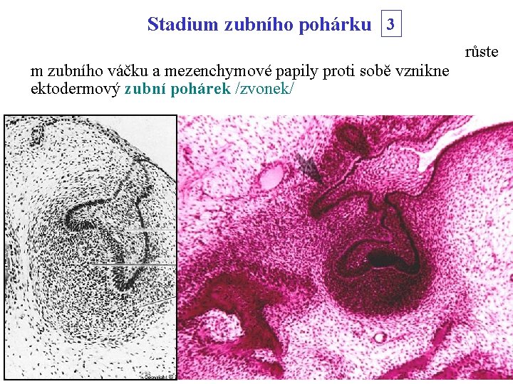 Stadium zubního pohárku 3 růste m zubního váčku a mezenchymové papily proti sobě vznikne