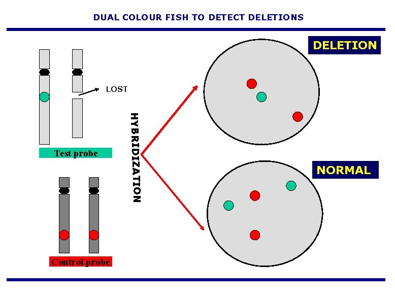 DUAL COLOUR FISH TO DETECT DELETIONS DELETION LOST Control probe HYBRIDIZATION Test probe NORMAL