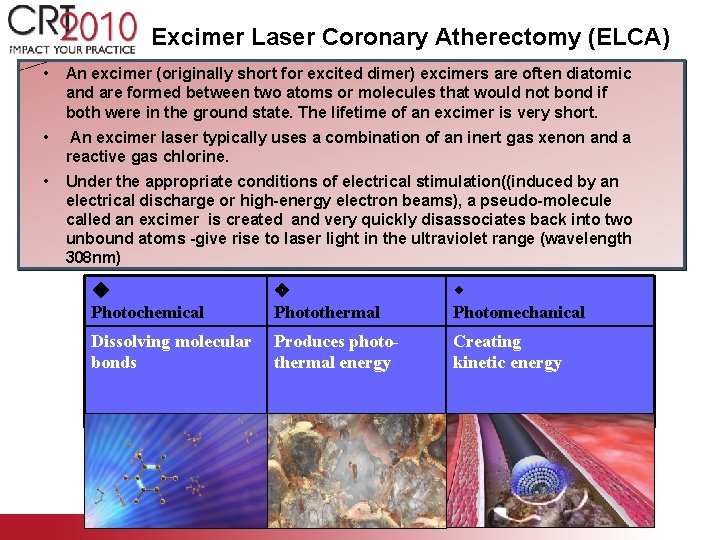 Excimer Laser Coronary Atherectomy (ELCA) • An excimer (originally short for excited dimer) excimers