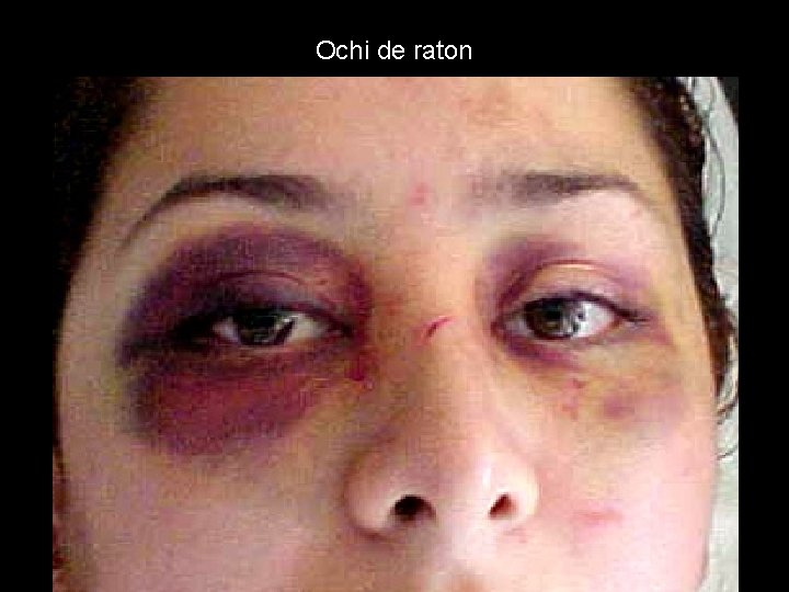 Ochi de raton Ochi de raton
