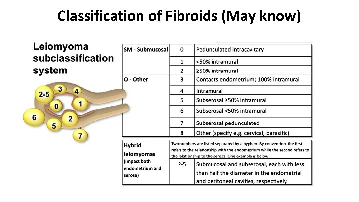 Classification of Fibroids (May know) 