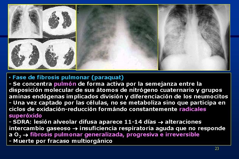 ▪ Fase de fibrosis pulmonar (paraquat) - Se concentra pulmón de forma activa por