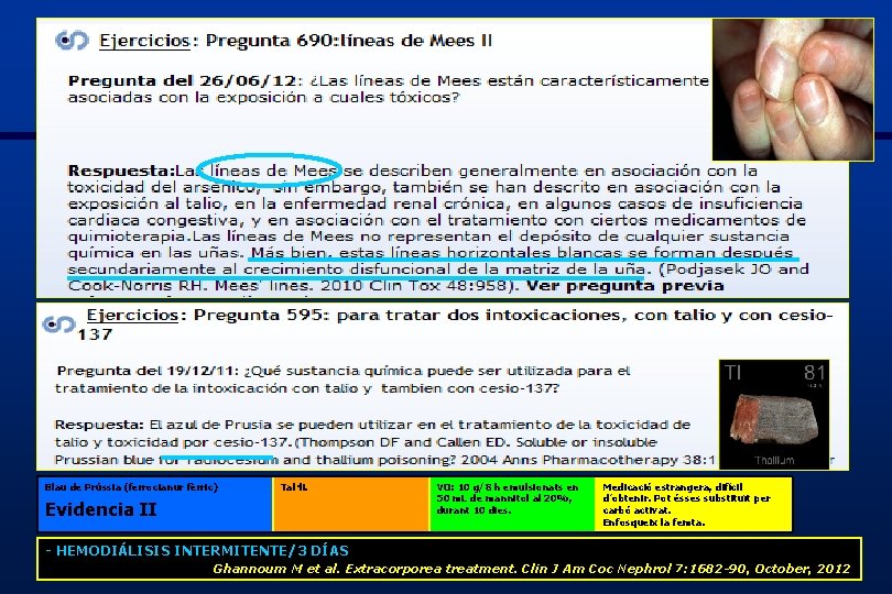 Blau de Prússia (ferrocianur fèrric) Tal·li. Evidencia II - HEMODIÁLISIS INTERMITENTE/3 DÍAS VO: 10