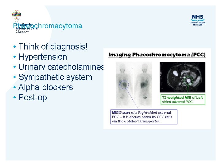 Phaeochromacytoma • • • Think of diagnosis! Hypertension Urinary catecholamines Sympathetic system Alpha blockers