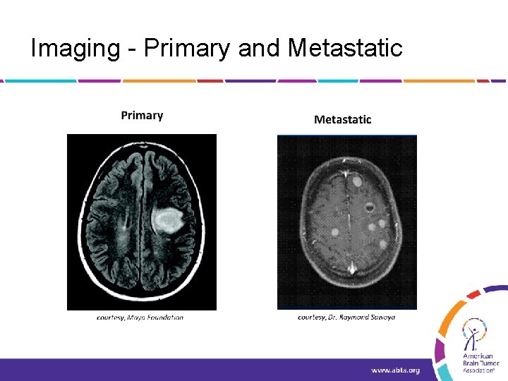 Imaging - Primary and Metastatic 