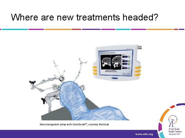 Where are new treatments headed? Neuronavigation setup with Vario. Guide™, courtesy Brain. Lab 