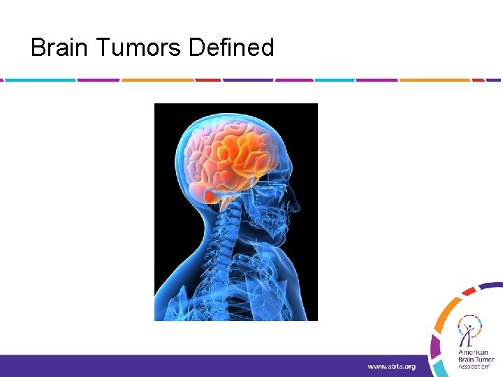 Brain Tumors Defined 