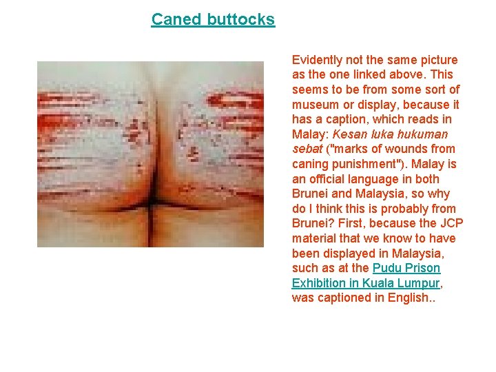 Caned buttocks Evidently not the same picture as the one linked above. This seems