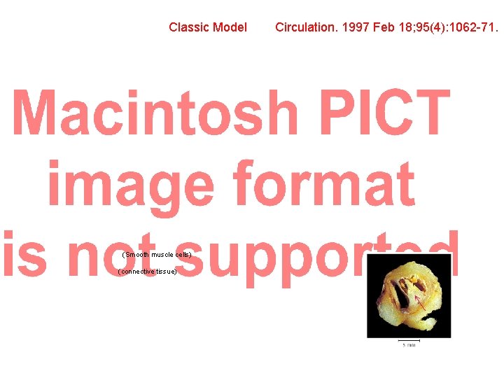 Classic Model (Smooth muscle cells) (connective tissue) Circulation. 1997 Feb 18; 95(4): 1062 -71.
