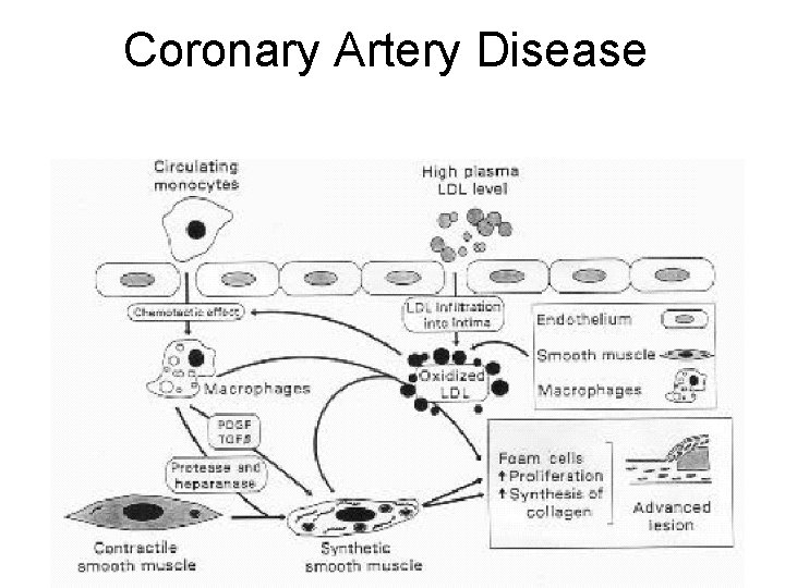 Coronary Artery Disease 