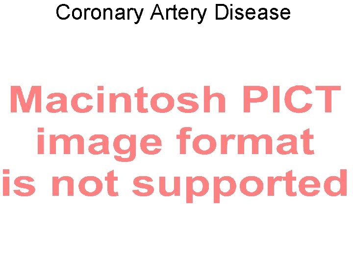 Coronary Artery Disease 