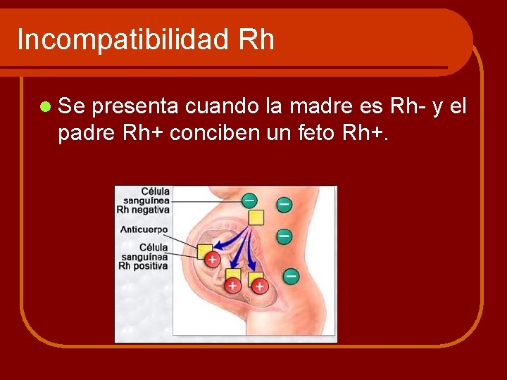 Incompatibilidad Rh l Se presenta cuando la madre es Rh- y el padre Rh+