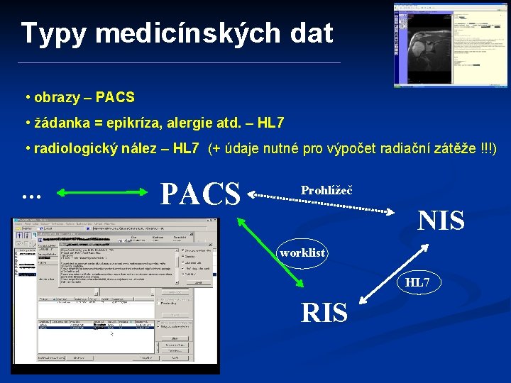 Typy medicínských dat • obrazy – PACS • žádanka = epikríza, alergie atd. –