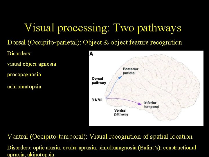 Visual processing: Two pathways Dorsal (Occipito-parietal): Object & object feature recognition Disorders: visual object