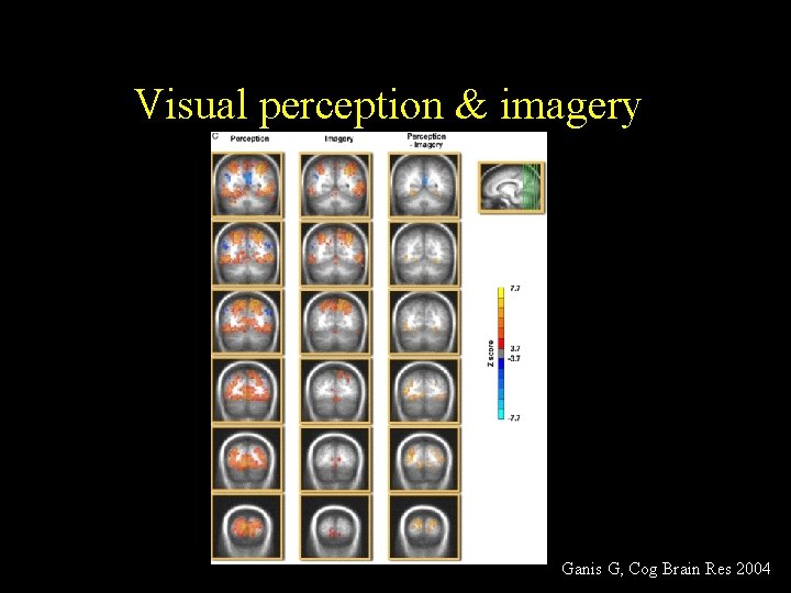 Visual perception & imagery Ganis G, Cog Brain Res 2004 