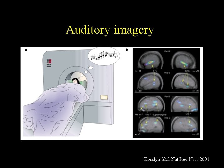 Auditory imagery Kosslyn SM, Nat Rev Nsci 2001 