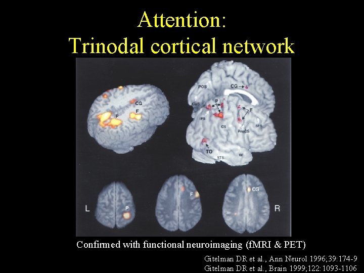 Attention: Trinodal cortical network Confirmed with functional neuroimaging (f. MRI & PET) Gitelman DR