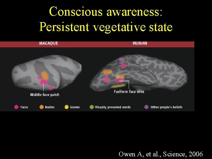 Conscious awareness: Persistent vegetative state Owen A, et al. , Science, 2006 