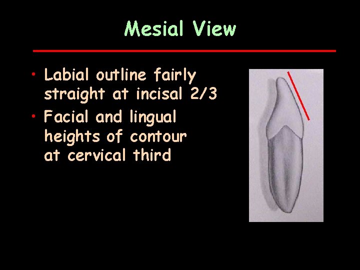 Mesial View • Labial outline fairly straight at incisal 2/3 • Facial and lingual