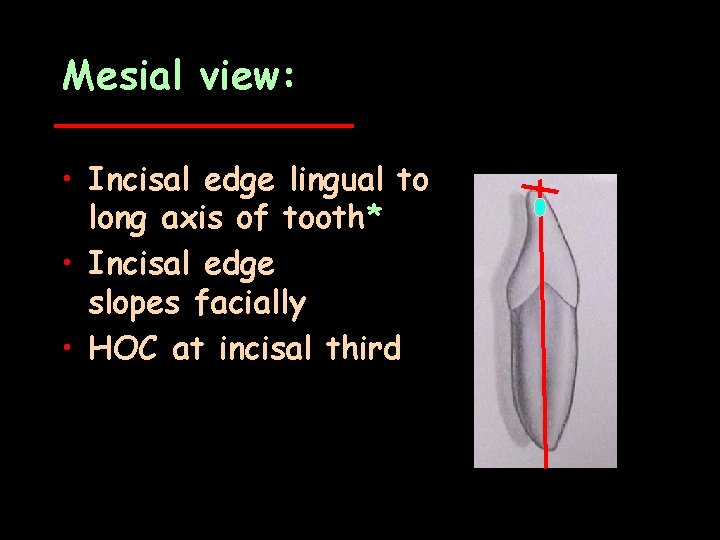 Mesial view: • Incisal edge lingual to long axis of tooth* • Incisal edge