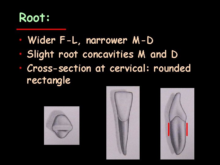 Root: • Wider F-L, narrower M-D • Slight root concavities M and D •