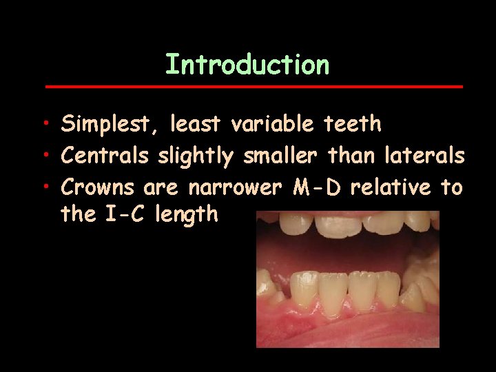 Introduction • Simplest, least variable teeth • Centrals slightly smaller than laterals • Crowns