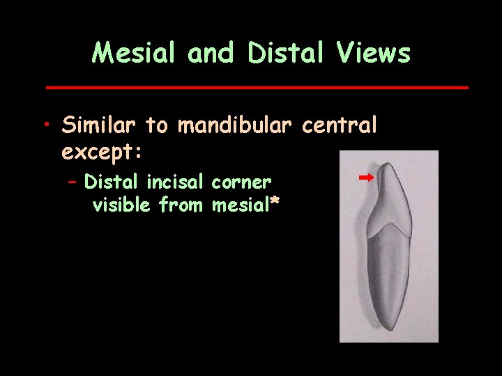 Mesial and Distal Views • Similar to mandibular central except: – Distal incisal corner