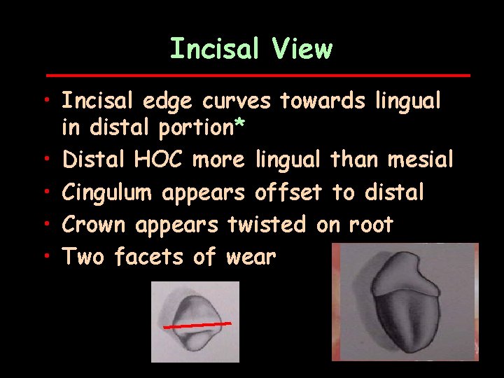 Incisal View • Incisal edge curves towards lingual in distal portion* • Distal HOC