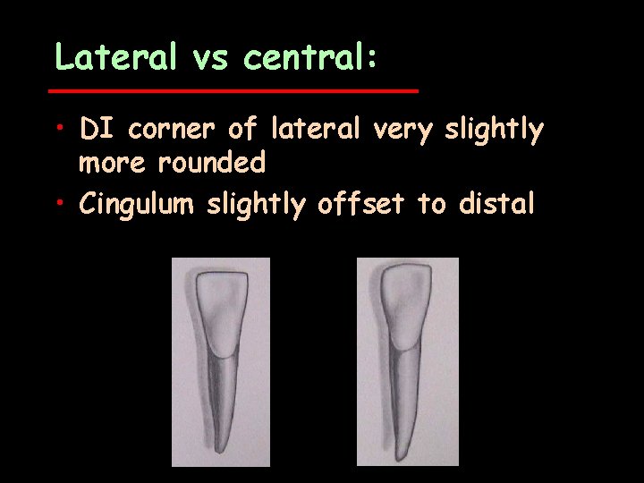 Lateral vs central: • DI corner of lateral very slightly more rounded • Cingulum