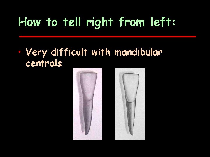 How to tell right from left: • Very difficult with mandibular centrals 