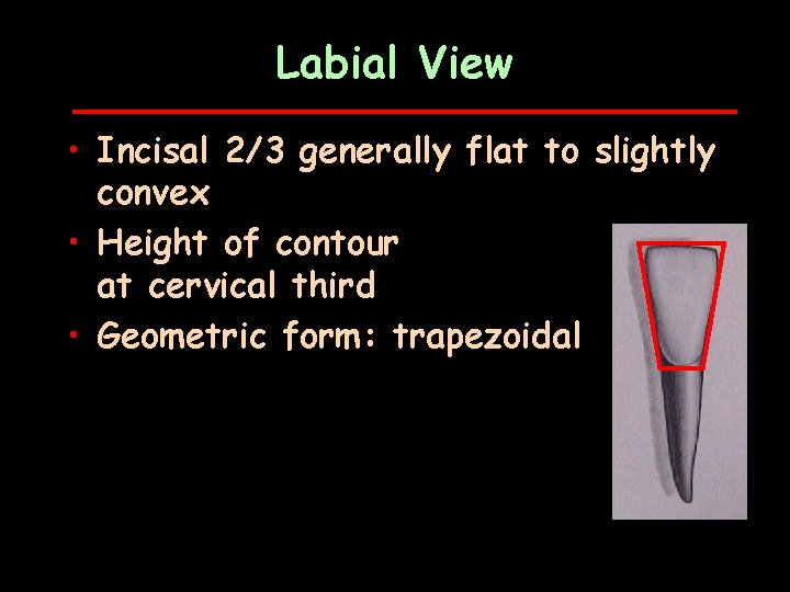 Labial View • Incisal 2/3 generally flat to slightly convex • Height of contour