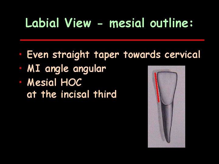 Labial View - mesial outline: • Even straight taper towards cervical • MI angle