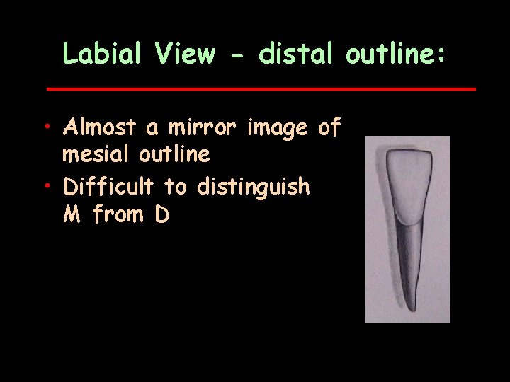 Labial View - distal outline: • Almost a mirror image of mesial outline •