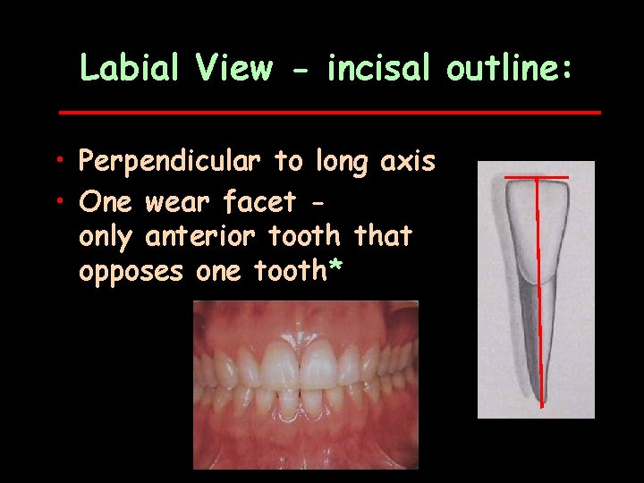 Labial View - incisal outline: • Perpendicular to long axis • One wear facet