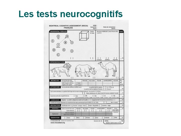 Les tests neurocognitifs 