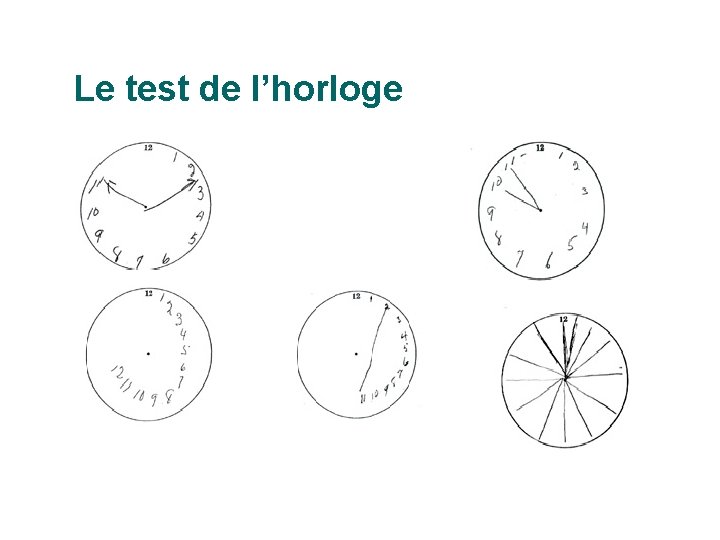 Le test de l’horloge 