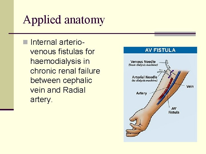 Applied anatomy n Internal arterio- venous fistulas for haemodialysis in chronic renal failure between