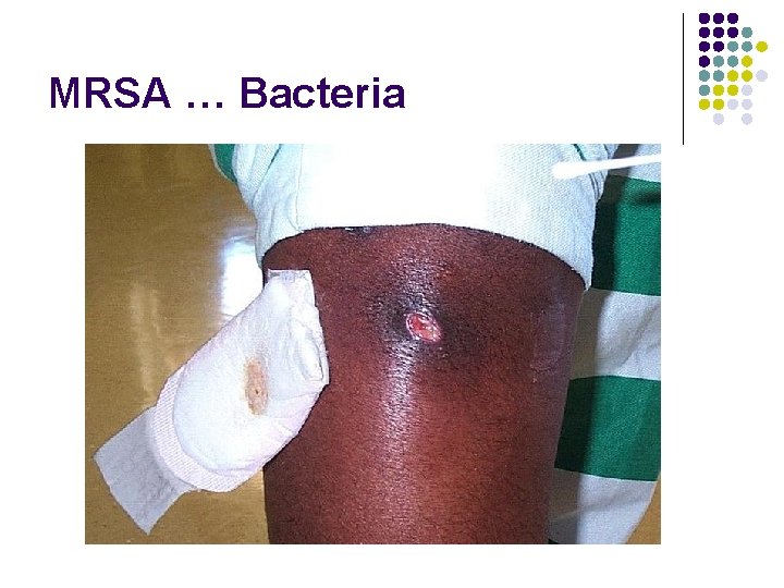 MRSA … Bacteria 