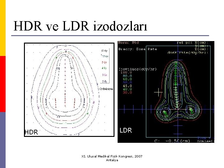 HDR ve LDR izodozları HDR LDR XI. Ulusal Medikal Fizik Kongresi, 2007 Antalya 