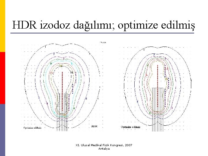 HDR izodoz dağılımı; optimize edilmiş XI. Ulusal Medikal Fizik Kongresi, 2007 Antalya 