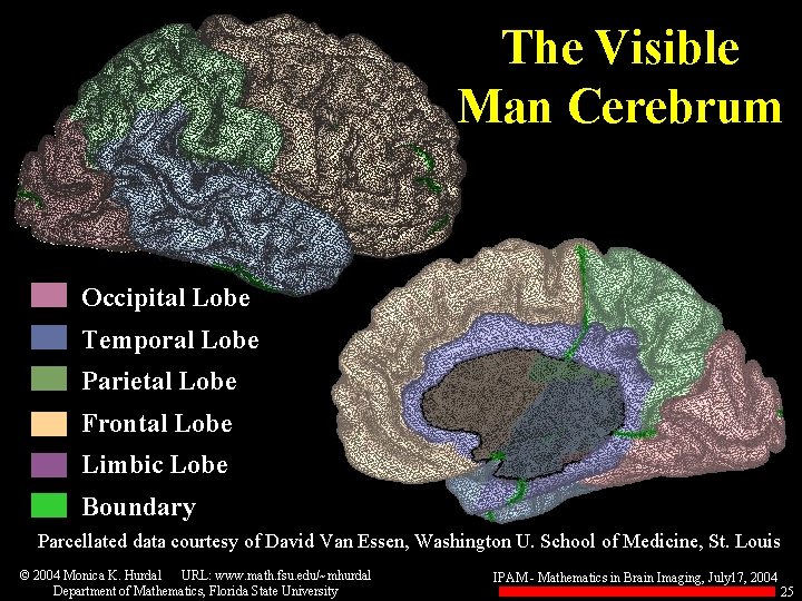 The Visible Man Cerebrum Occipital Lobe Temporal Lobe Parietal Lobe Frontal Lobe Limbic Lobe