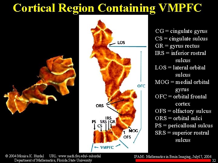 Cortical Region Containing VMPFC CG = cingulate gyrus CS = cingulate sulcus GR =
