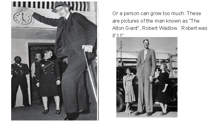 Or a person can grow too much. These are pictures of the man known
