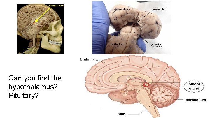 Can you find the hypothalamus? Pituitary? 